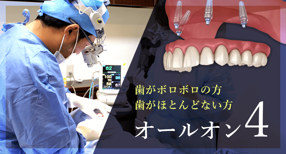 オールオン4 オールオンフォー 総入れ歯の方のインプラント 大阪インプラント総合クリニック